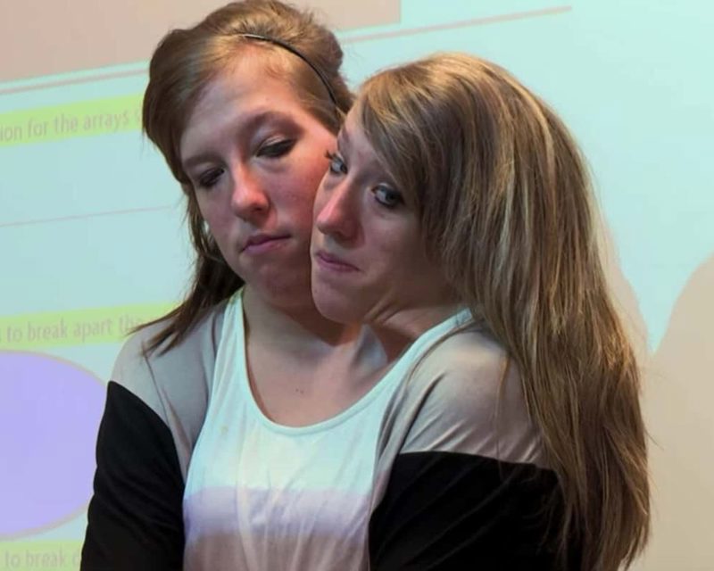 Conjoined twins Abby and Brittany Hensel from Minnesota set to become  reality TV stars - Mirror Online