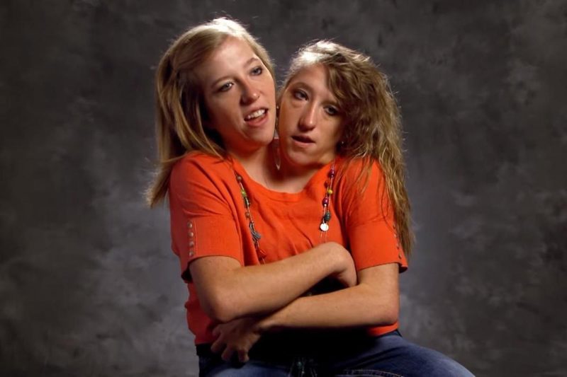 Conjoined twins Abby and Brittany Hensel from Minnesota set to become  reality TV stars - Mirror Online